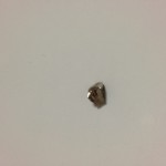 右下の歯の詰め物が取れたやん～munejyuka日記－2012/1/8